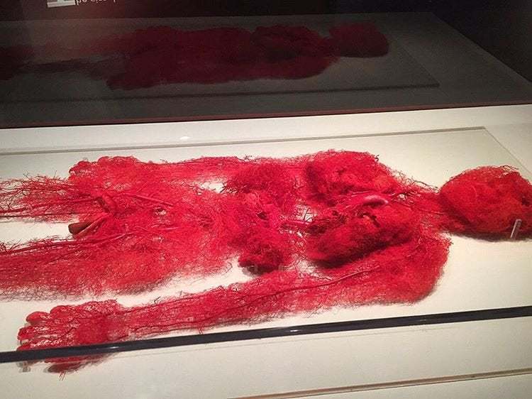 Real Blood Vessels From A Person Who Donated Their Body Scrolller