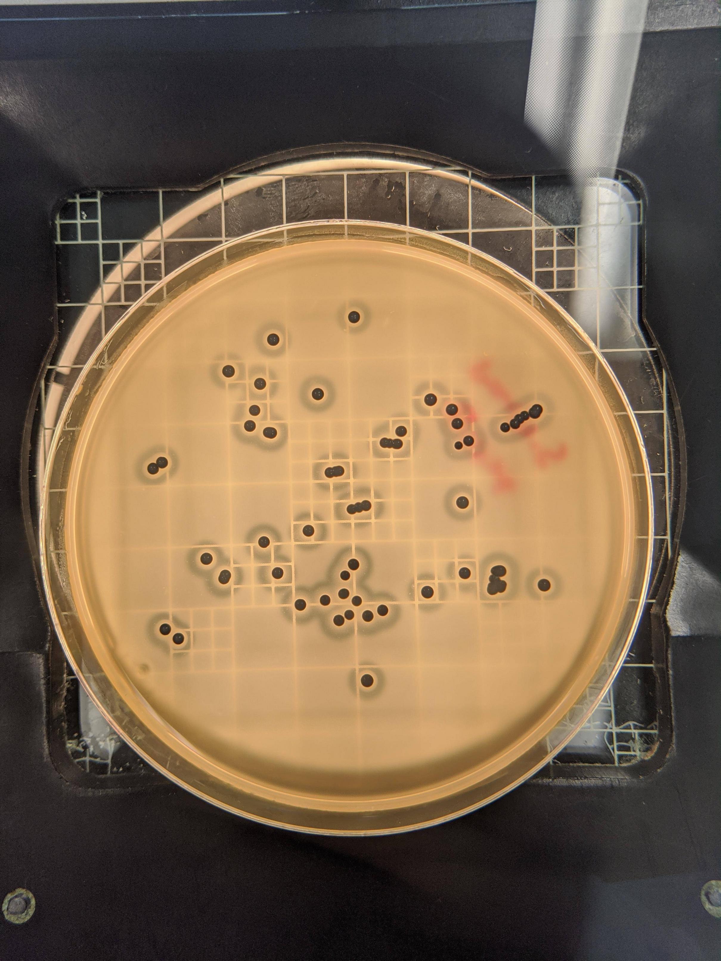 S Aureus On Baird Parker Agar Scrolller