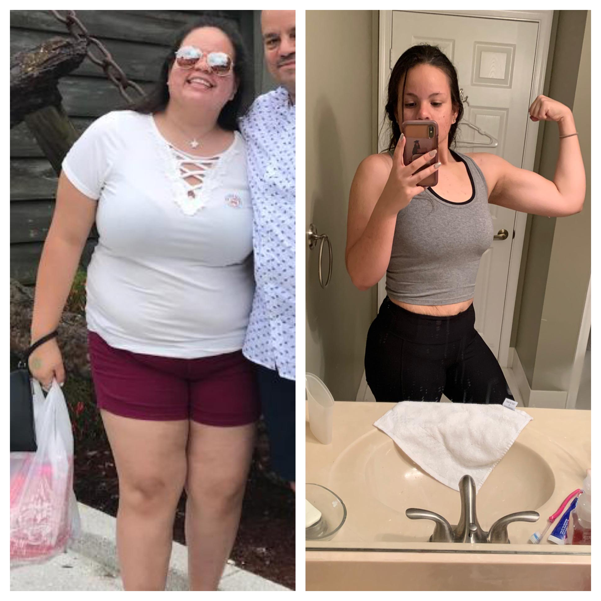 at-17-years-old-i-was-weighing-281-pounds-and-one-year-later-i-am-down