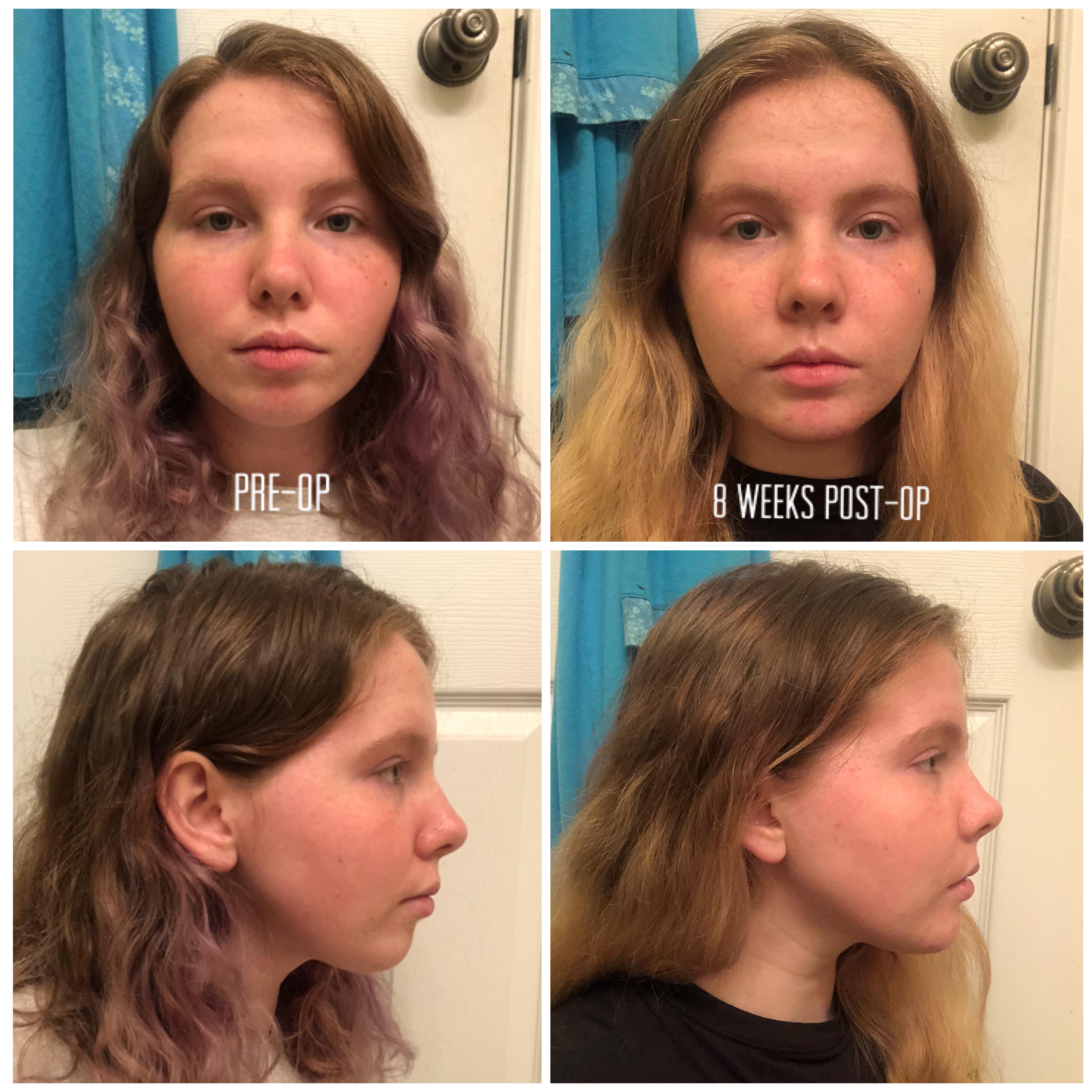 Before And After Djs Genio Scrolller