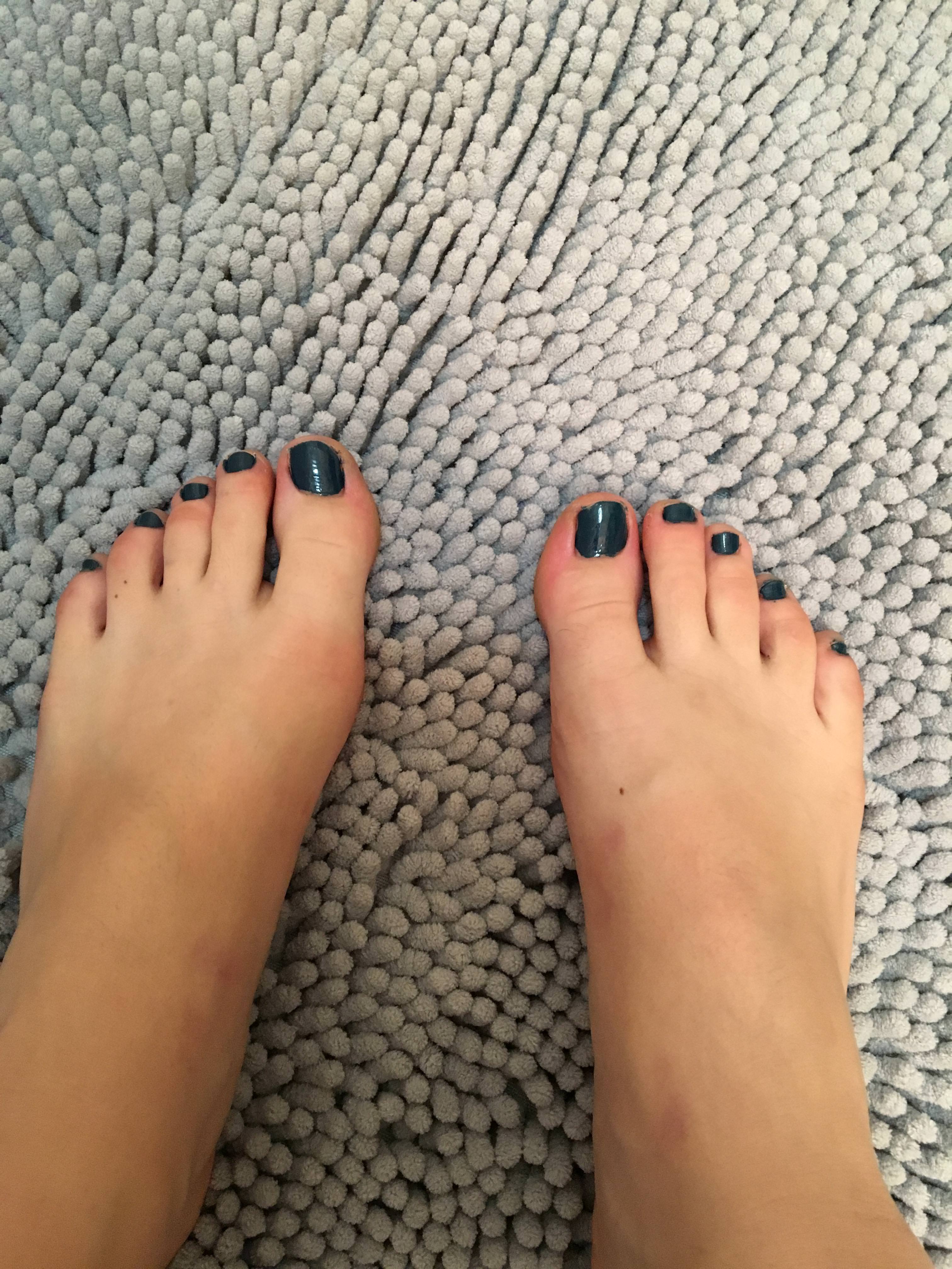 Clean toes | Scrolller