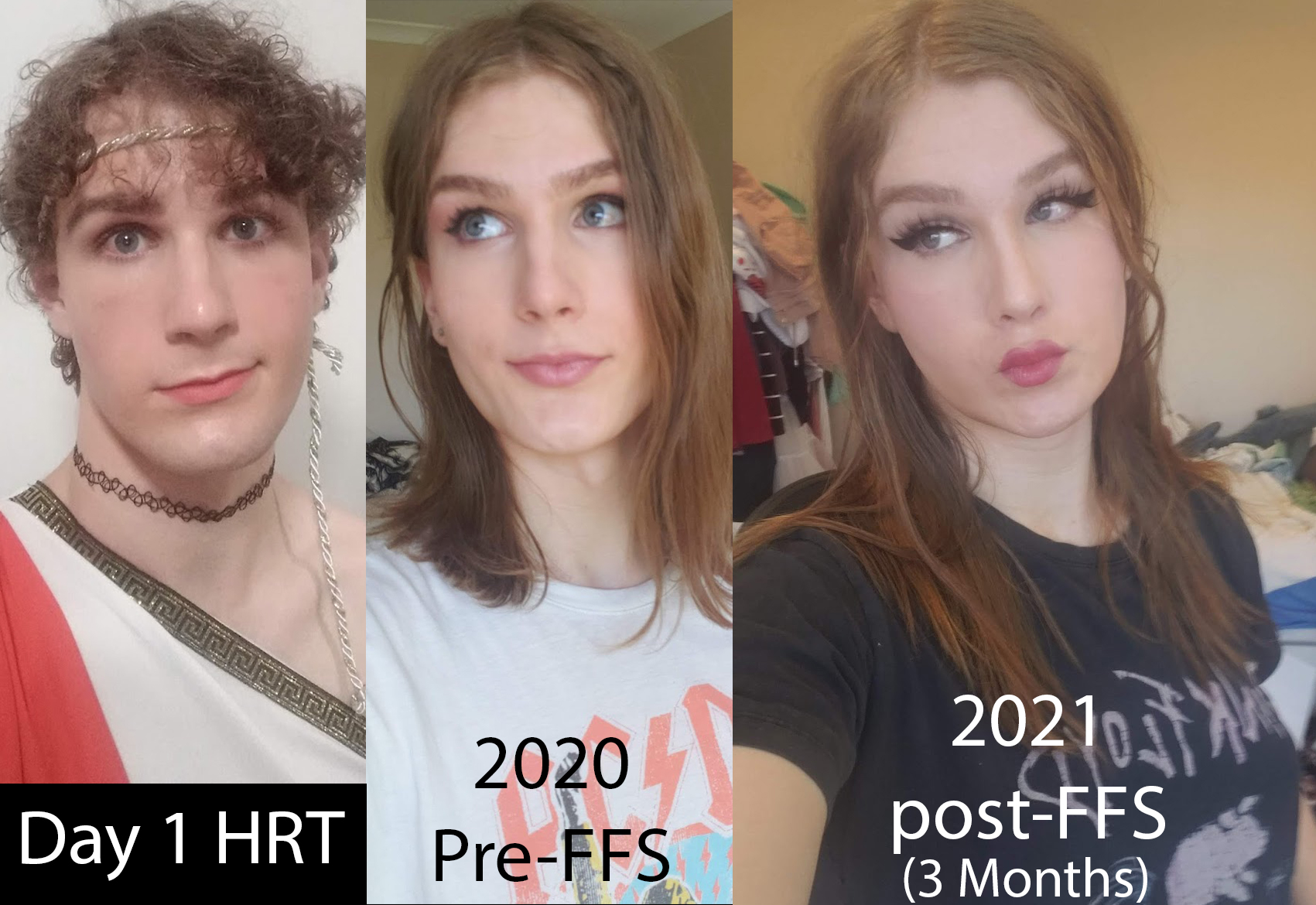 Comparing My First Day Of Trying Makeup To Now [20yo Post Ffs] Scrolller