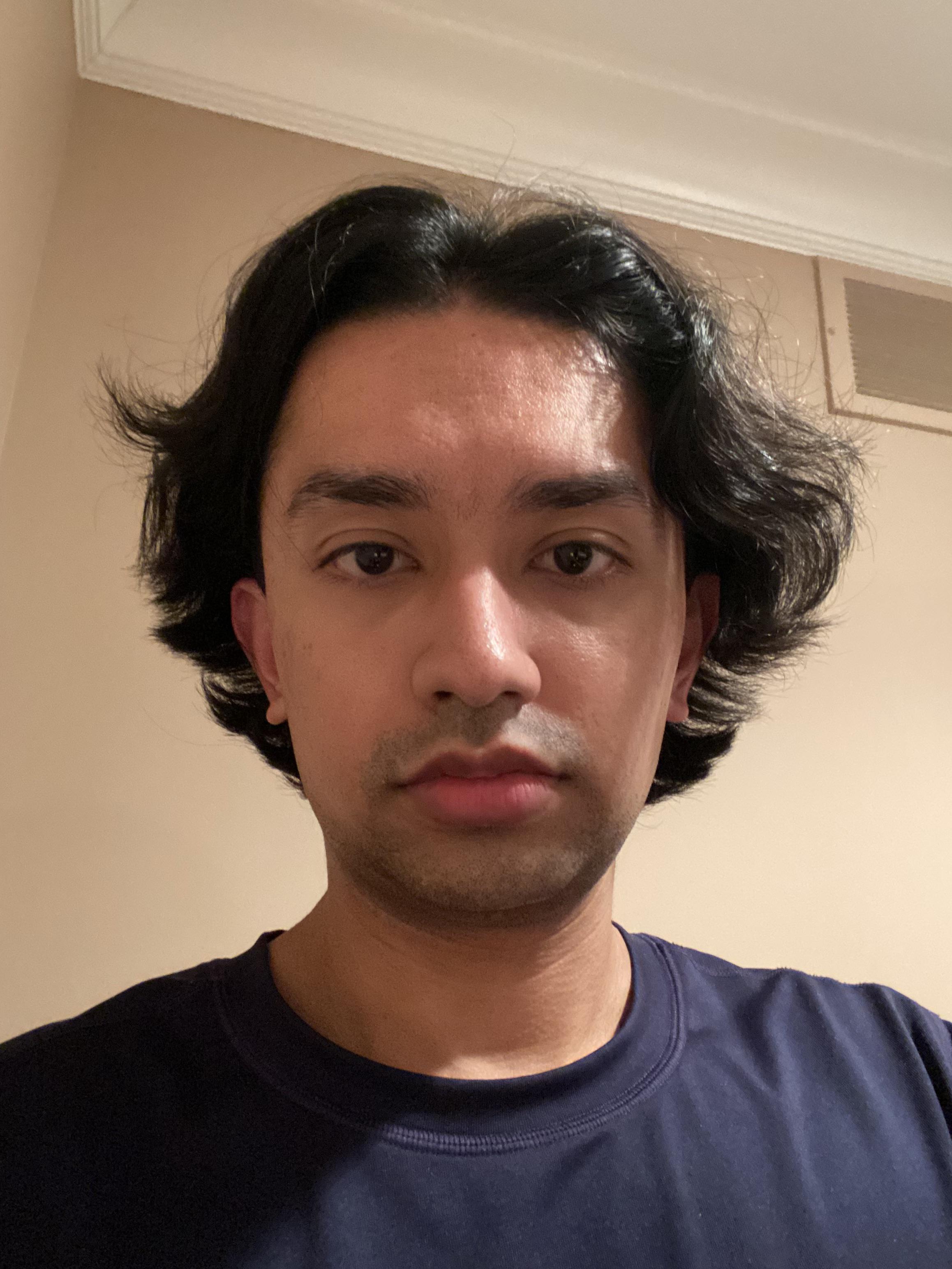 Does Anyone Know What To Do About Hair Flow directionality Mine Is does-anyone-know-what-to-do-about-hair-flow-directionality-mine-is