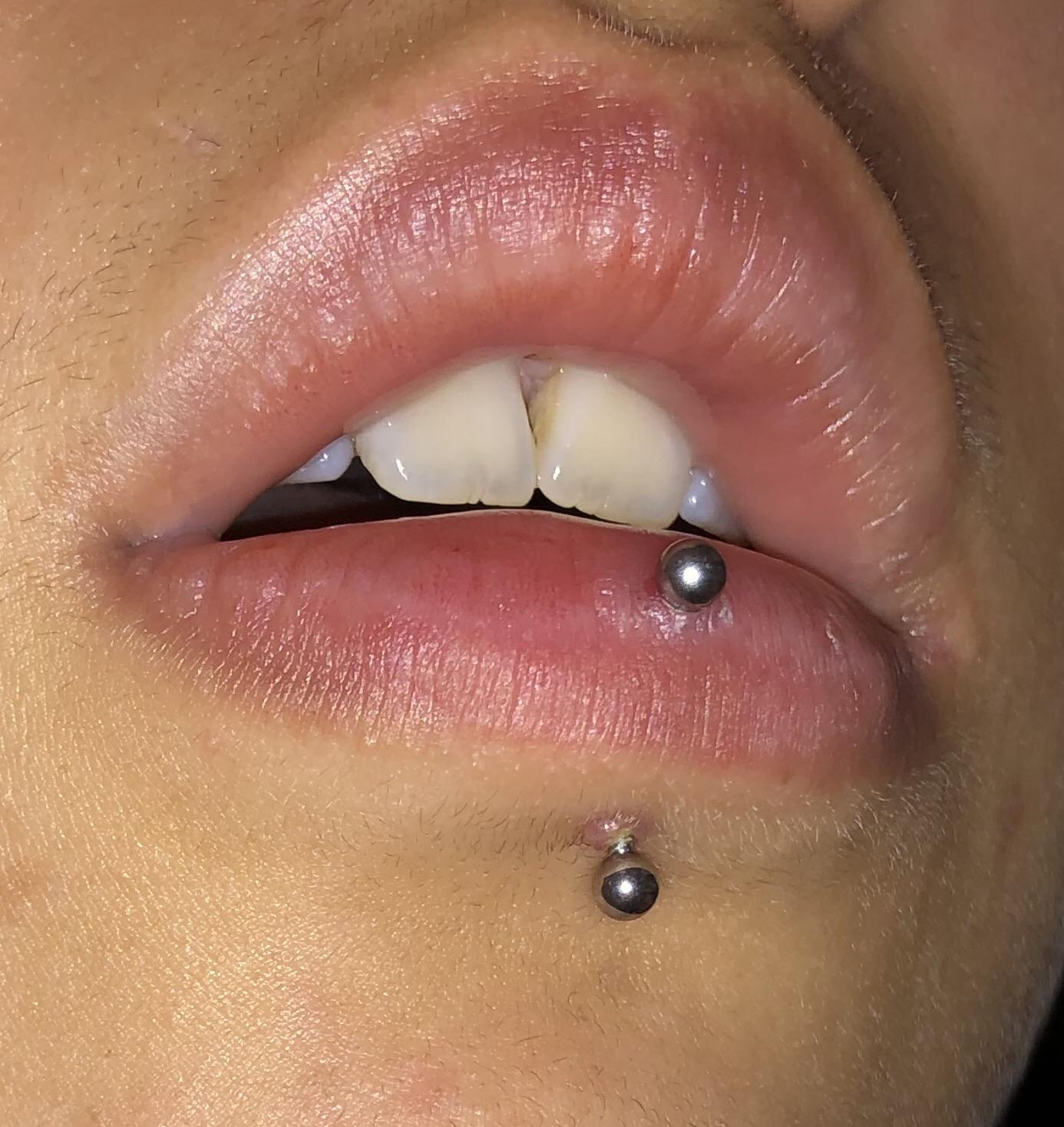 had-my-vertical-labret-pierced-5-weeks-ago-it-s-formed-a-small-red