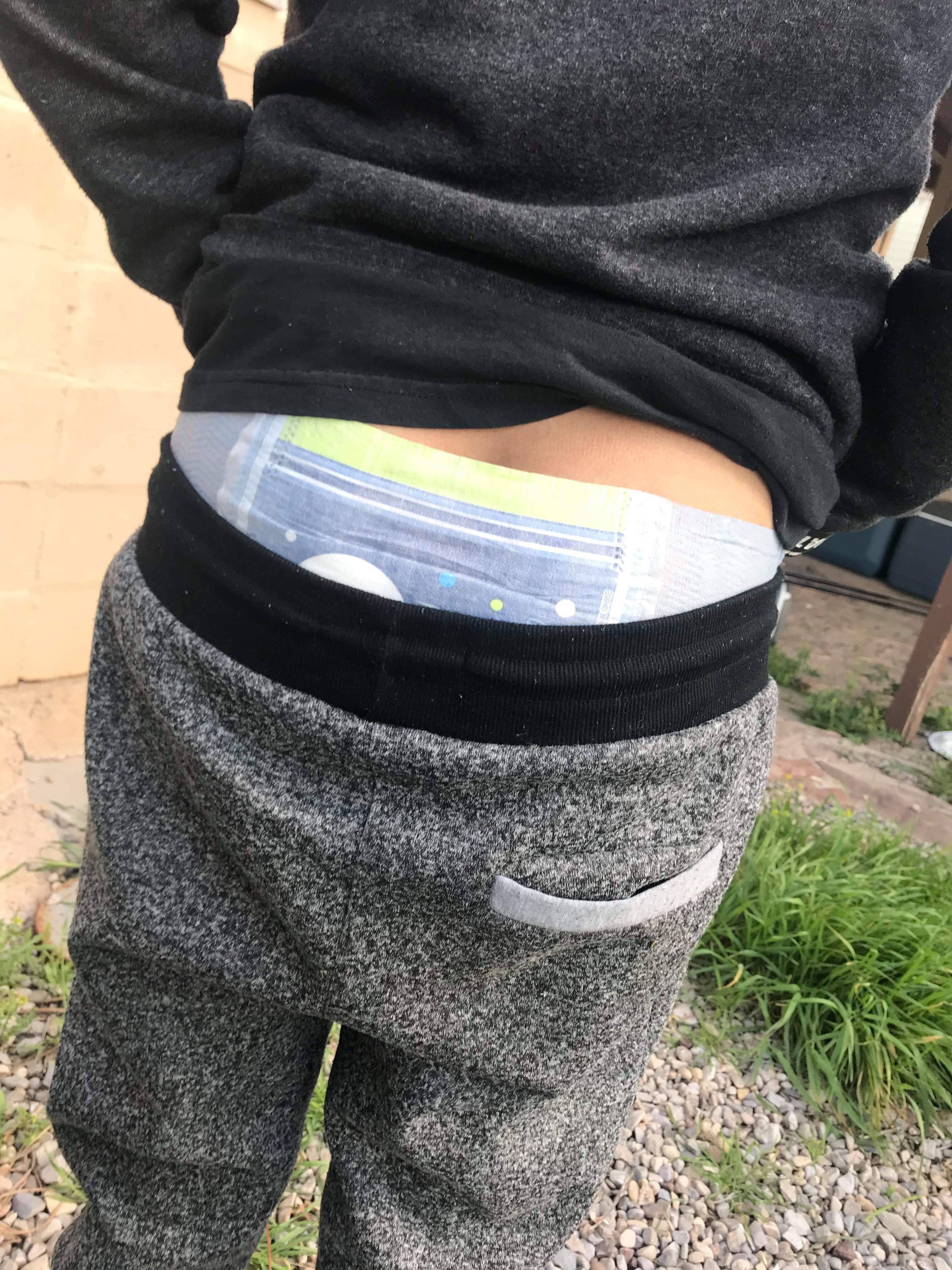 Mommy got a pic of my diaper peeking out | Scrolller