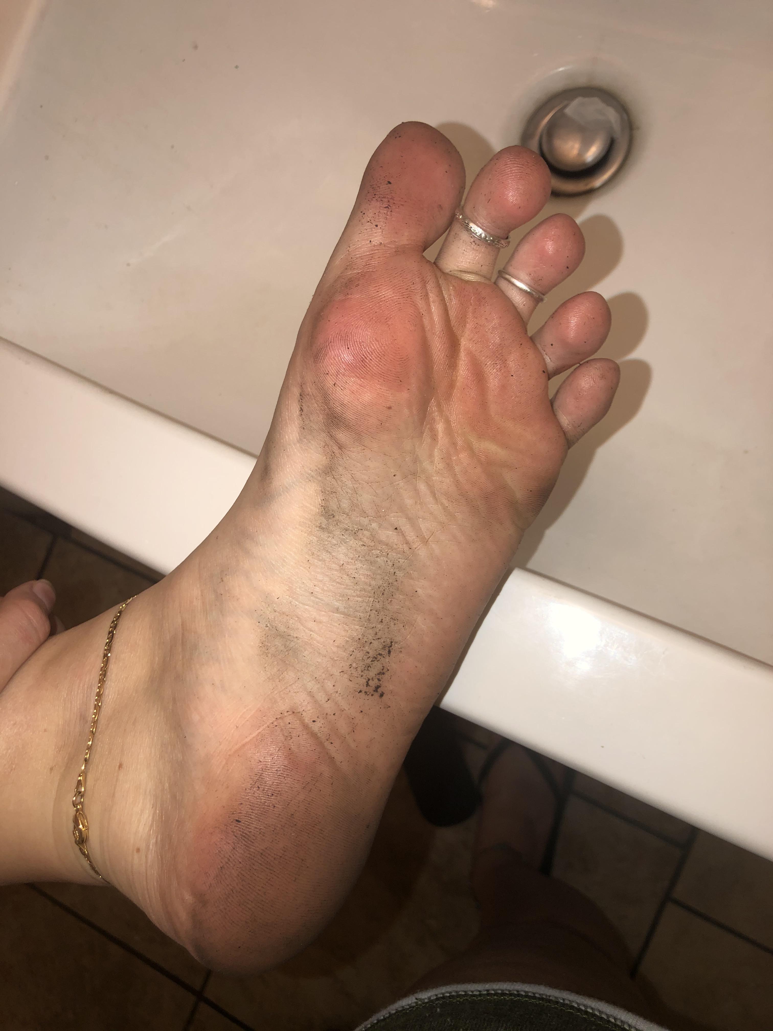 My feet get DISGUSTING at work🥴🤮 | Scrolller