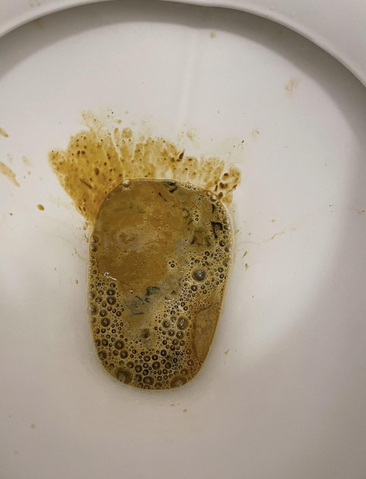 Painting the town brown 💩💦 Scrolller