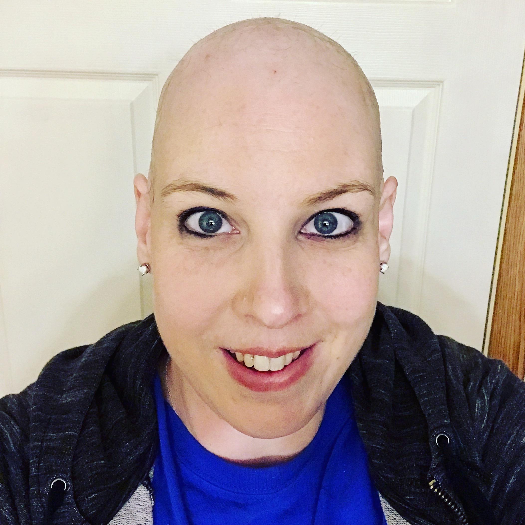 Rocking The Bald Look During Chemo Three Years Ago. | Scrolller