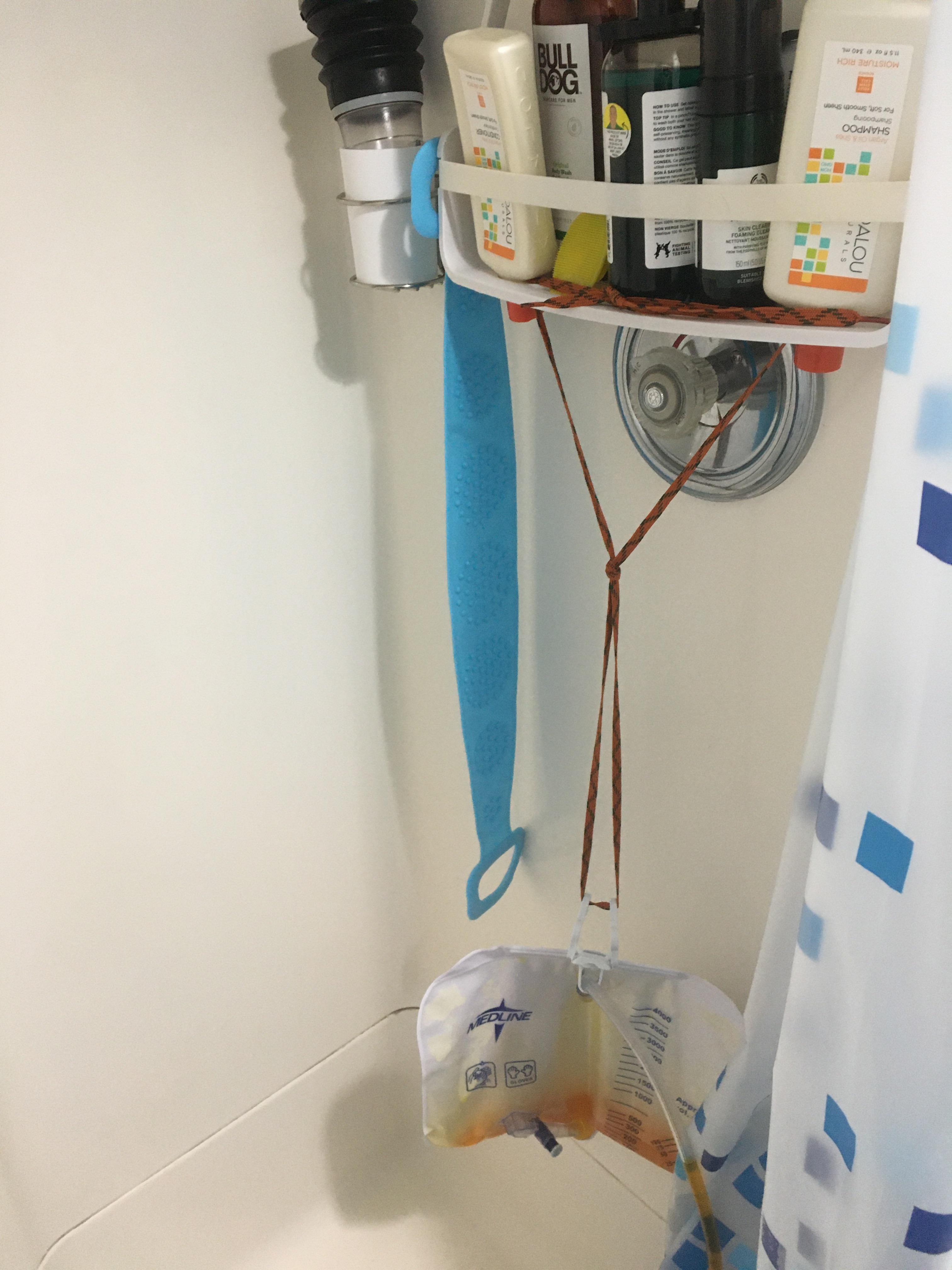 Simple hack for showering with a catheter bag Scrolller