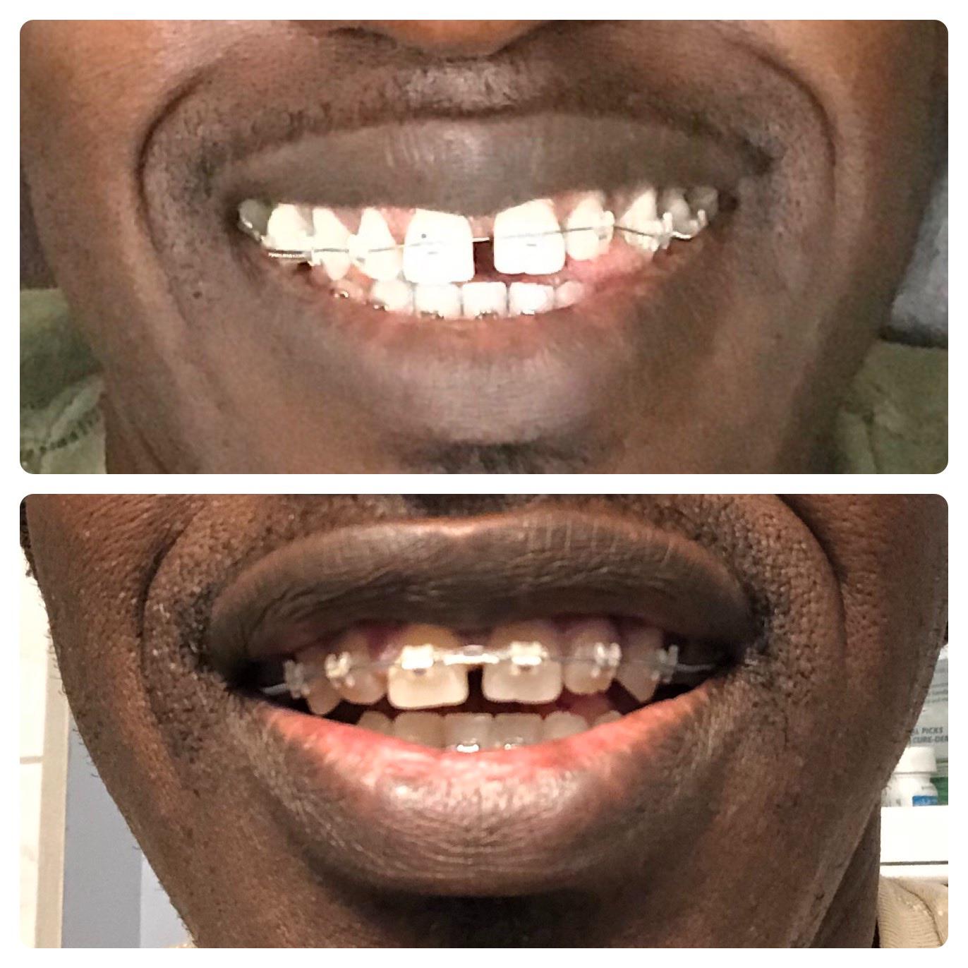 Six Months In Scrolller