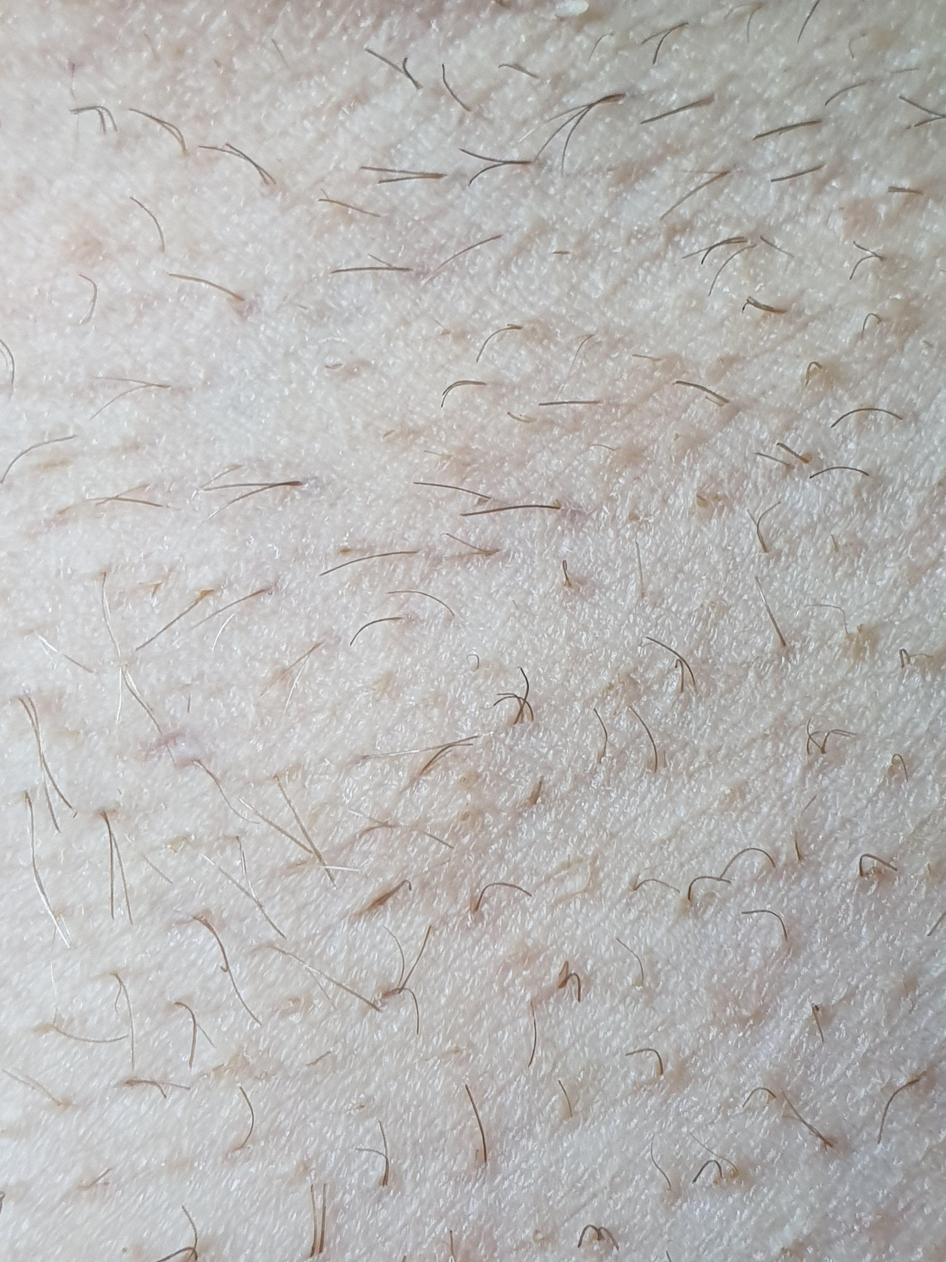 Some of the pili multigemini from one of my pits... | Scrolller