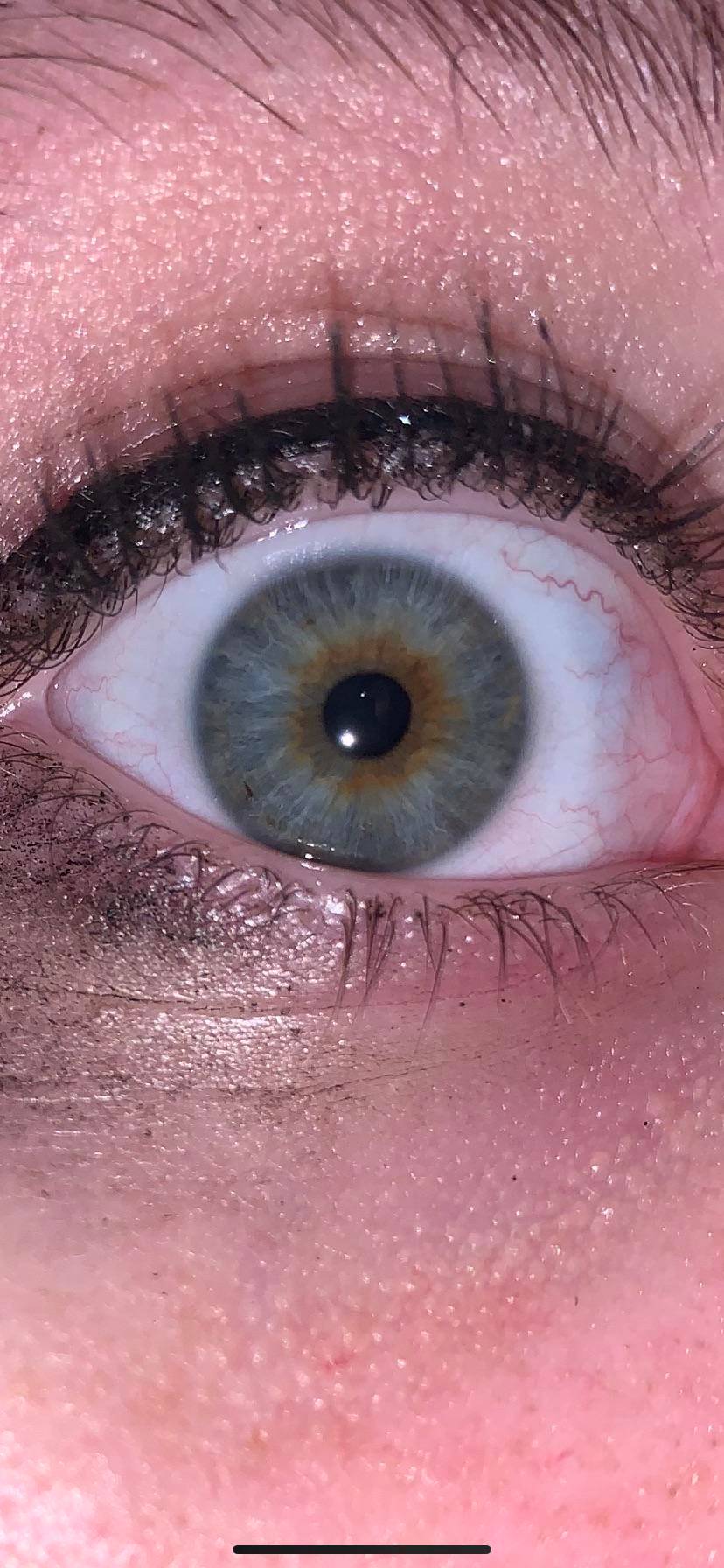 Sorry If Spam But Is This Central Heterochromia Scrolller 