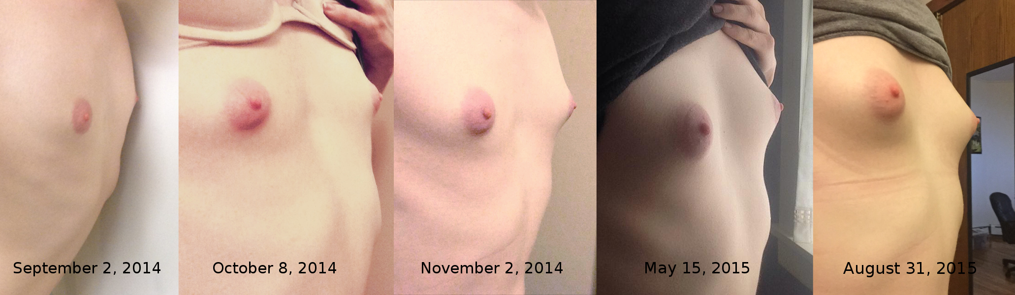 гормоны для роста груди женщин фото 35