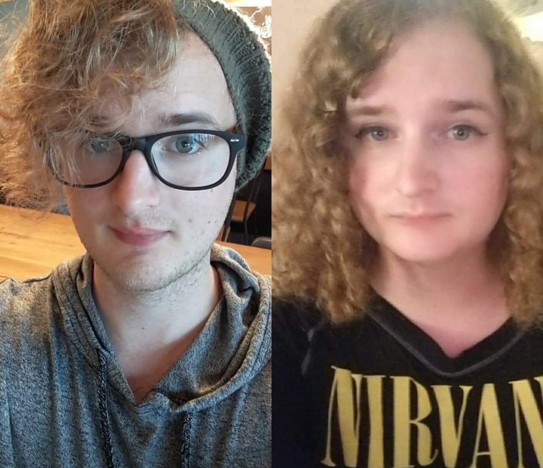 6 months pre-transition to 2 years hrt. | Scrolller