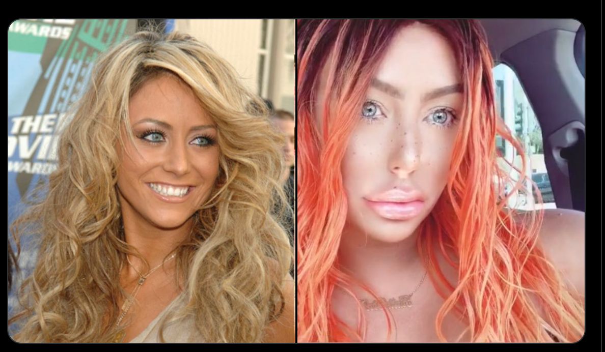 Aubrey o day before and after scrolller