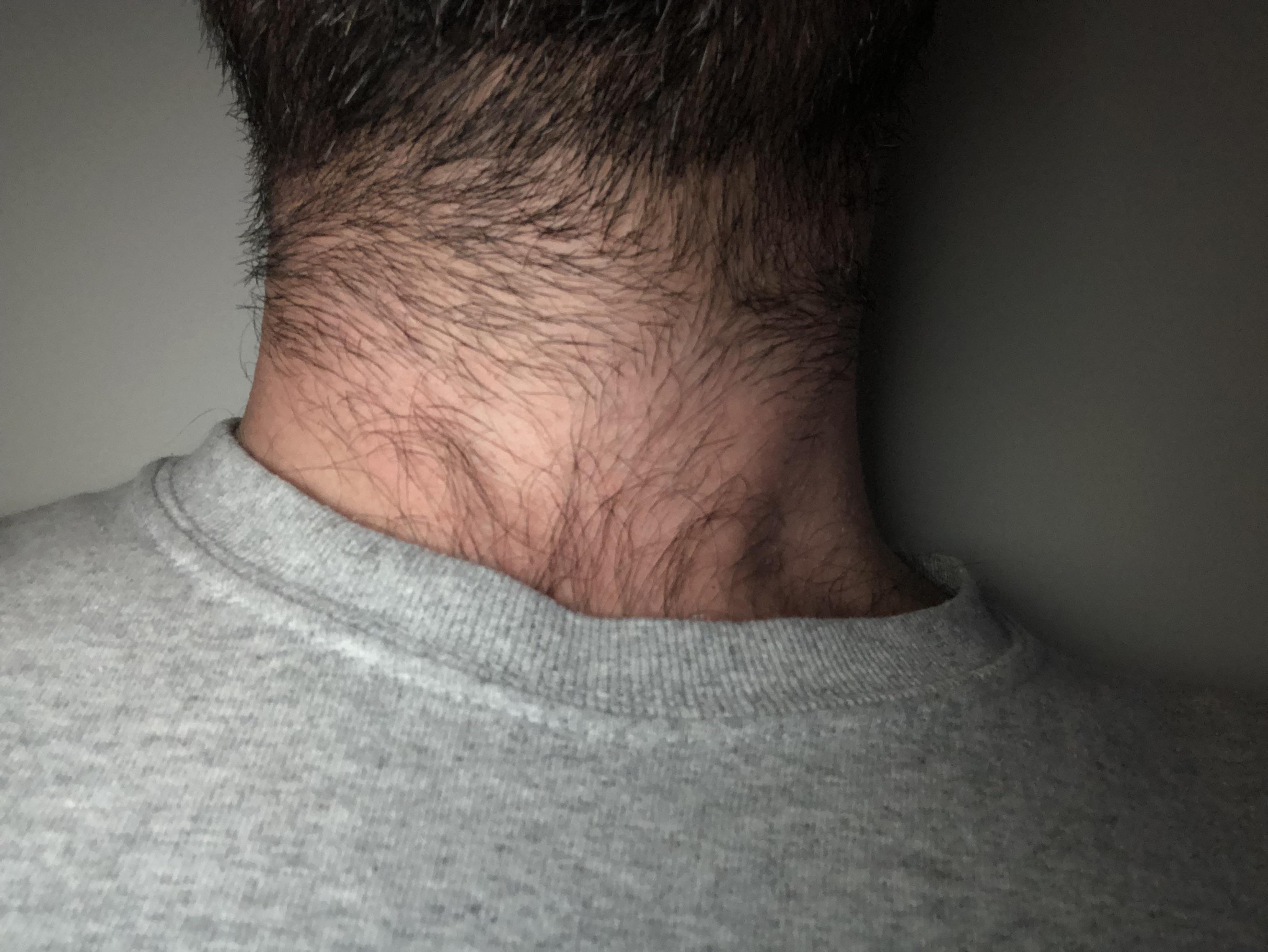 Beard Connected to Chest Hair: Stylish Grooming Fusion Guide