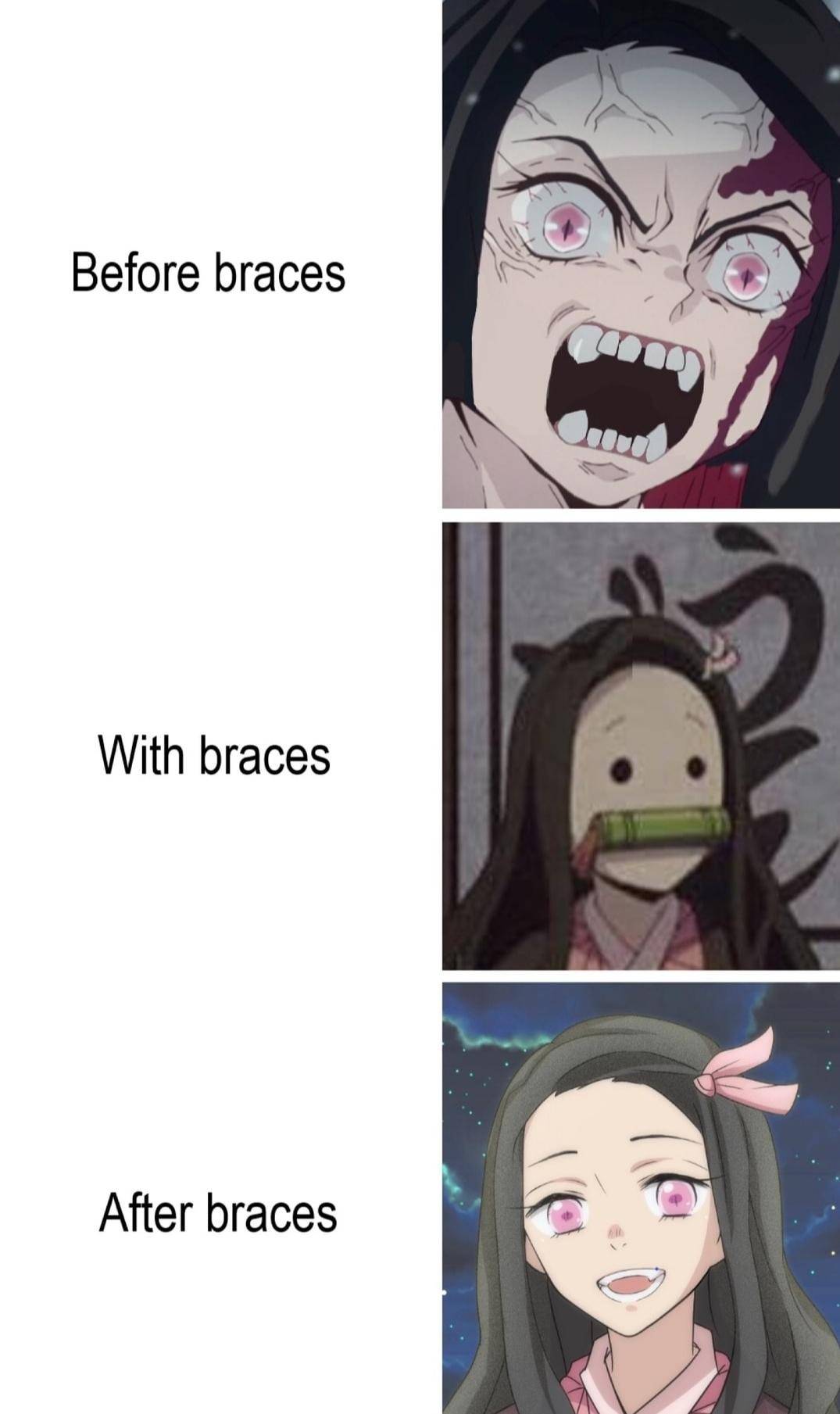 Braces. | Scrolller