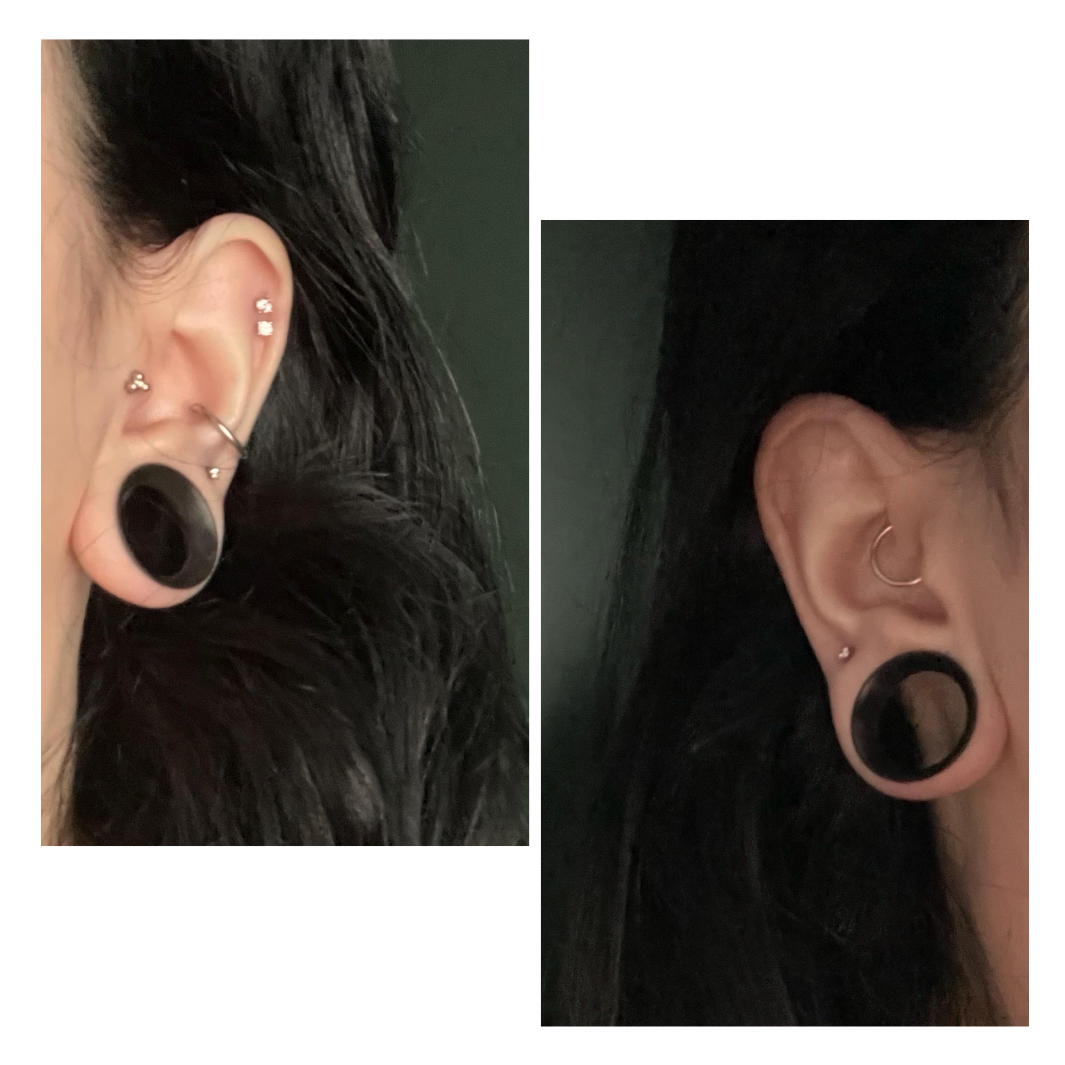 Fresh tragus and double lobe piercings. Ears at 3/4ths. Not sure what