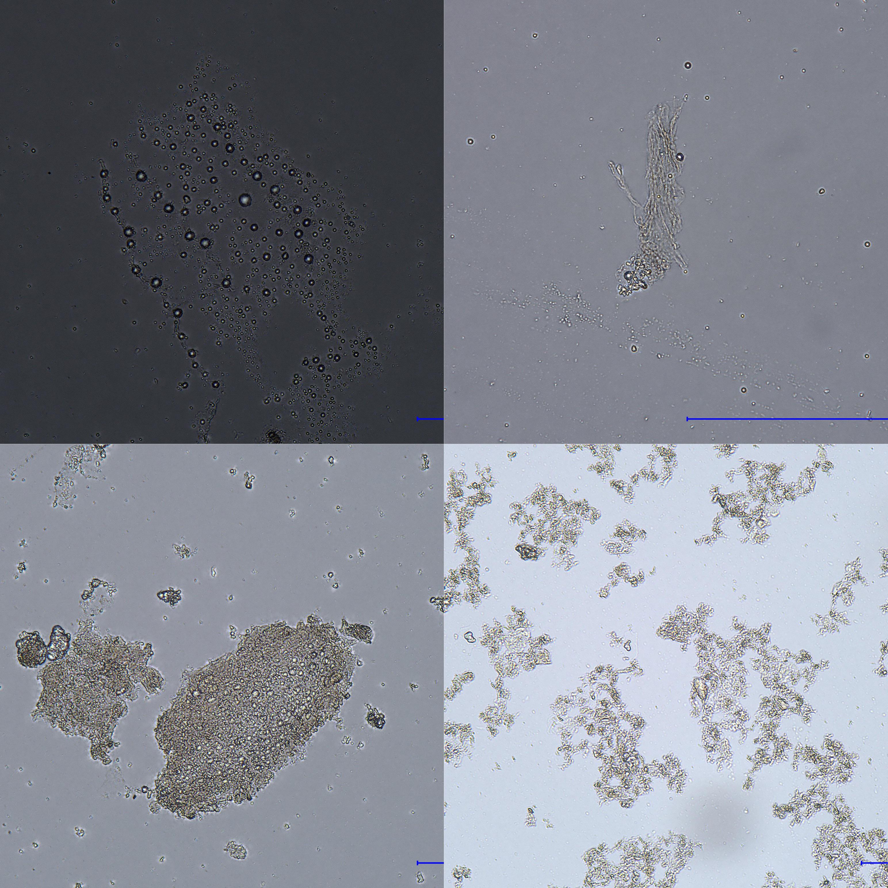 Help me identify! Skin scraping under microscope with KOH. Any signs of