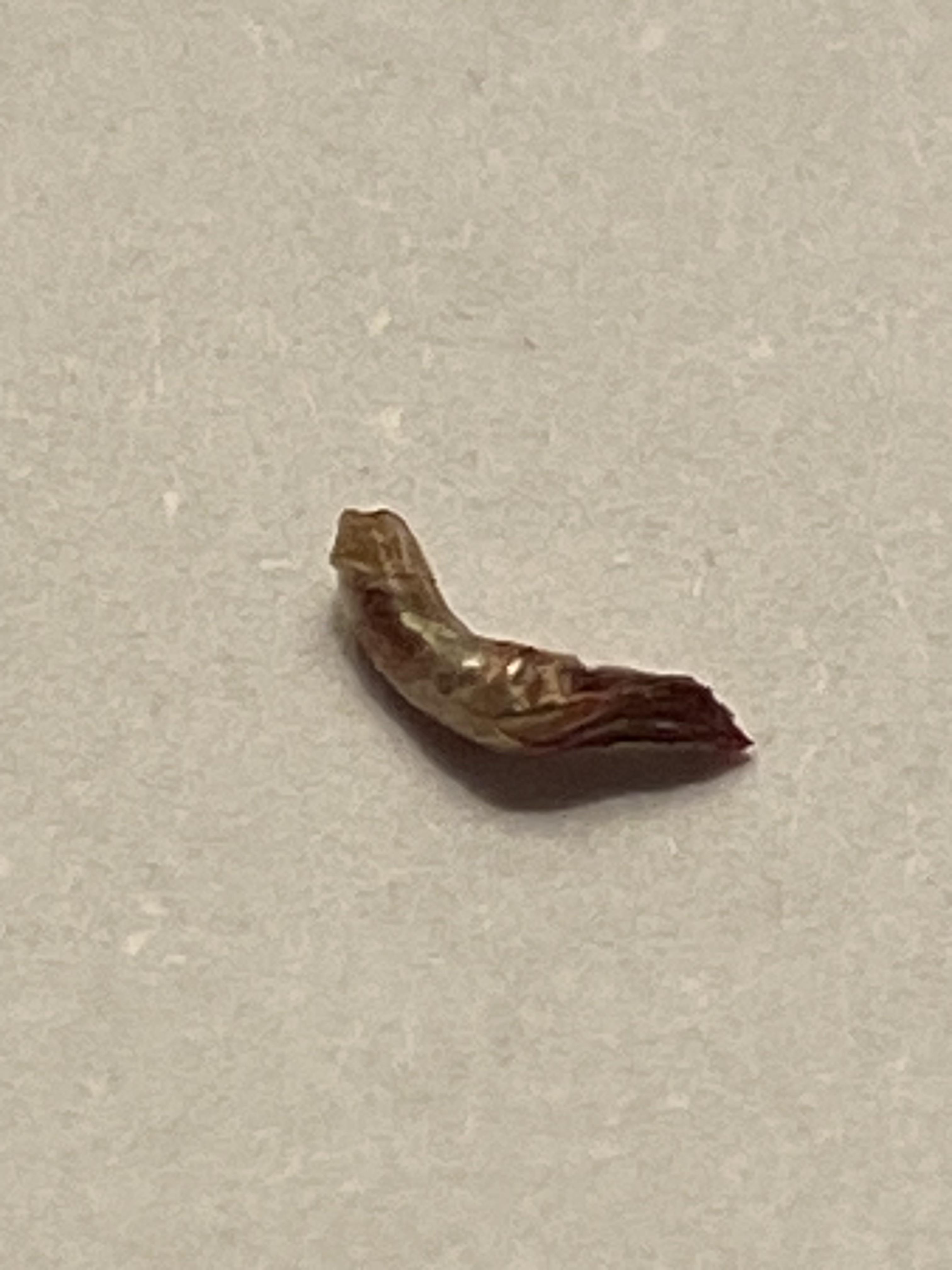 I have Pili Multigemini (multiple hairs growing out of one follicle). I  just popped this out of my chin. | Scrolller