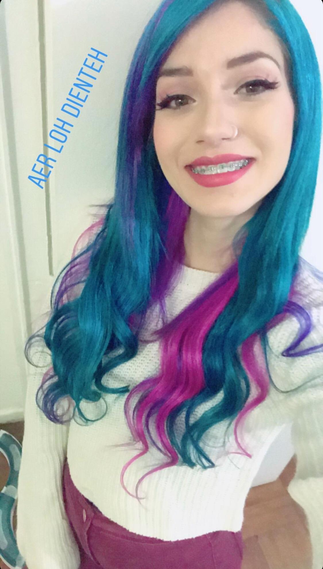 I really dig the braces Scrolller