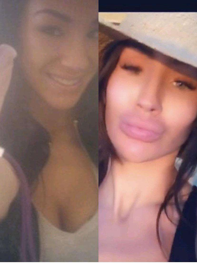 Instagram Model Carlye Myka when she was 19 VS Now 👀 💉👄 Scrolller