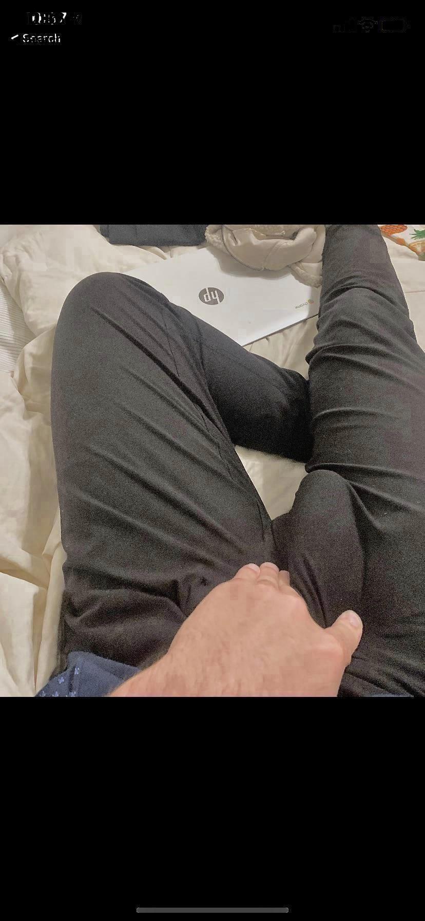 Massive Soft Bulge Pm Me If You Want Details On How Big It Gets Scrolller