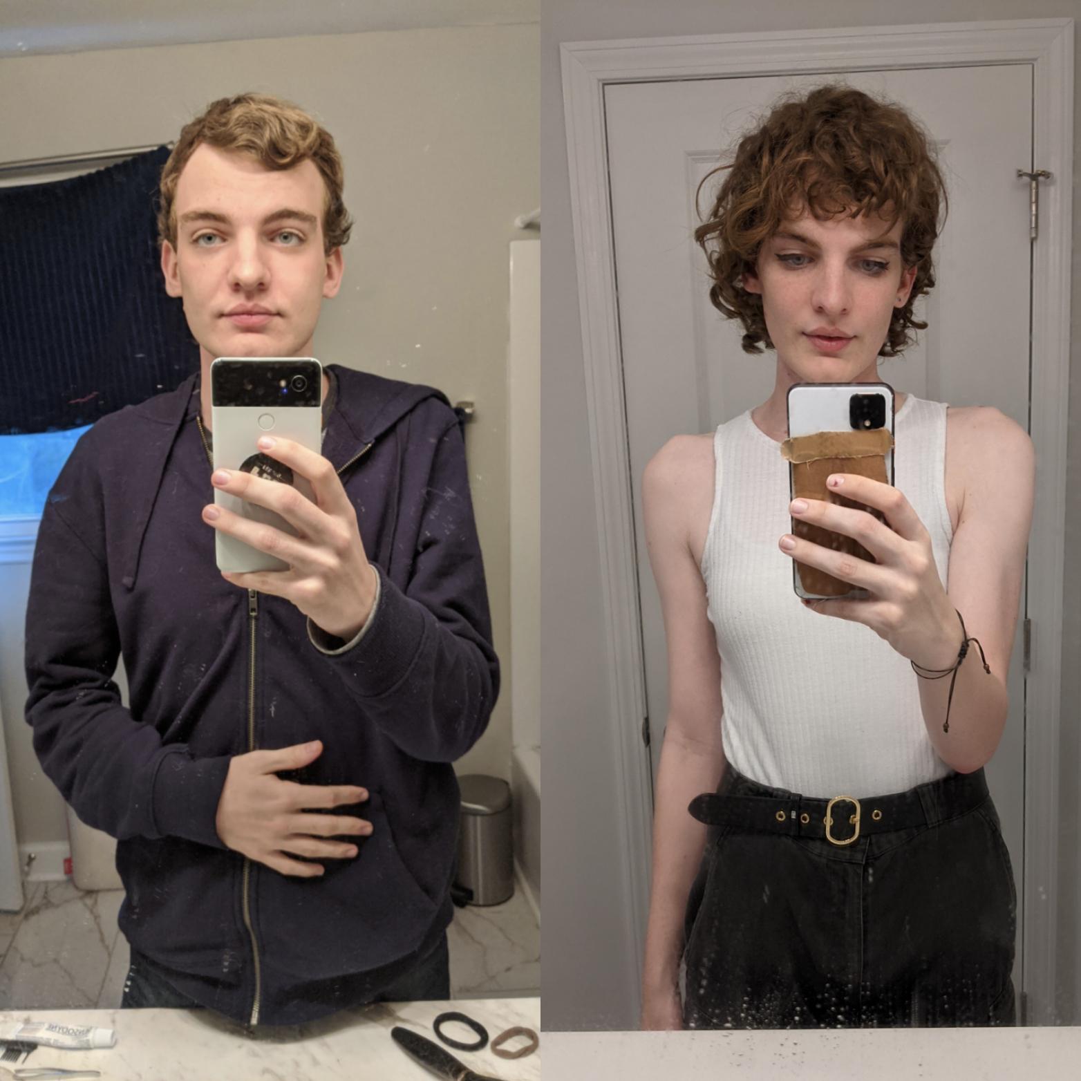 Pre Hrt Vs 10 Months Hrt Scrolller