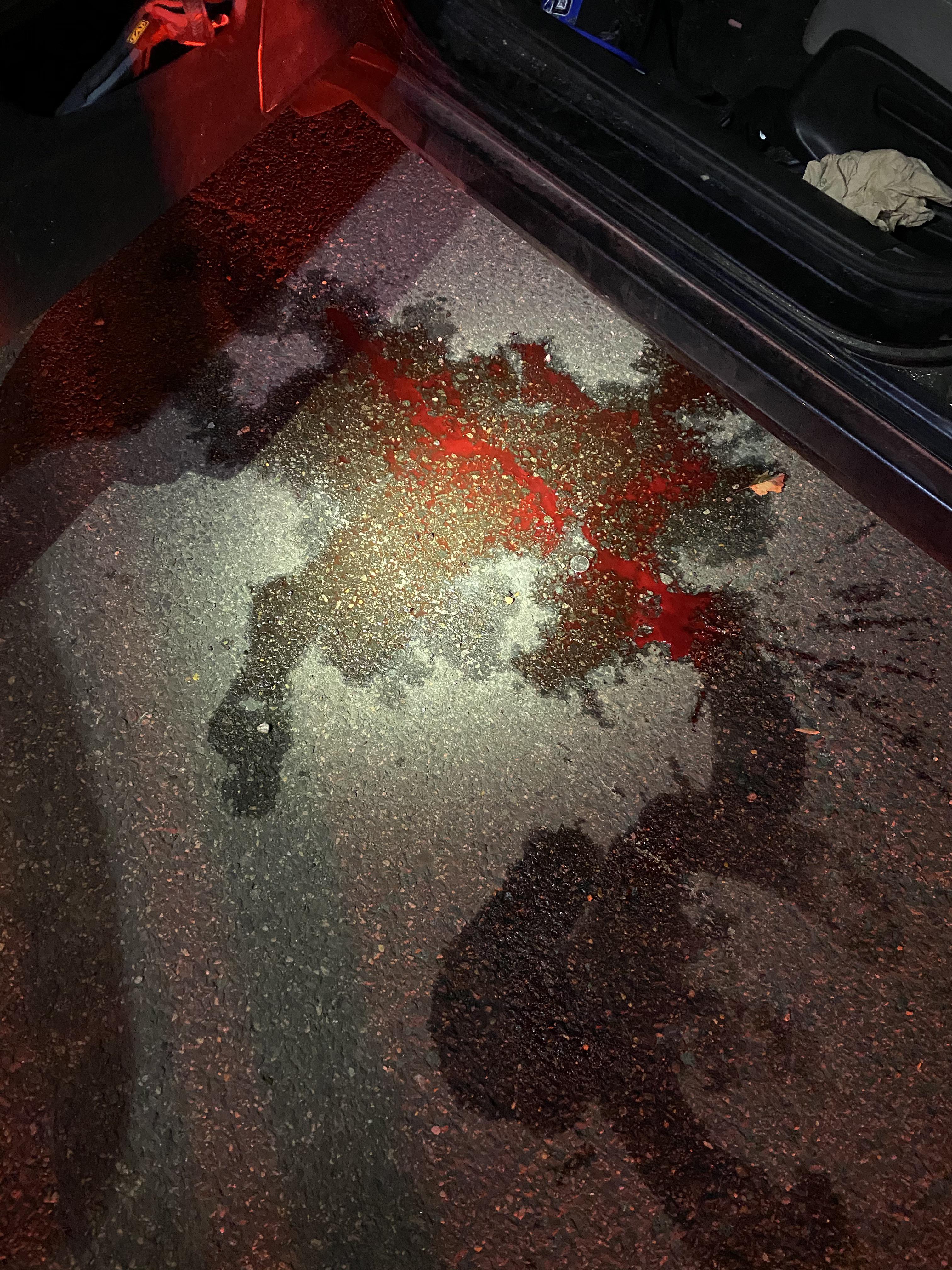 This is what happens when airbags rupture legs with edema Scrolller