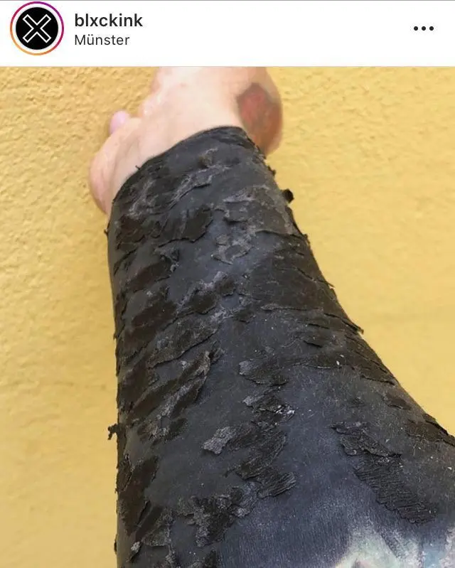 Three days after heavy black work tattooing