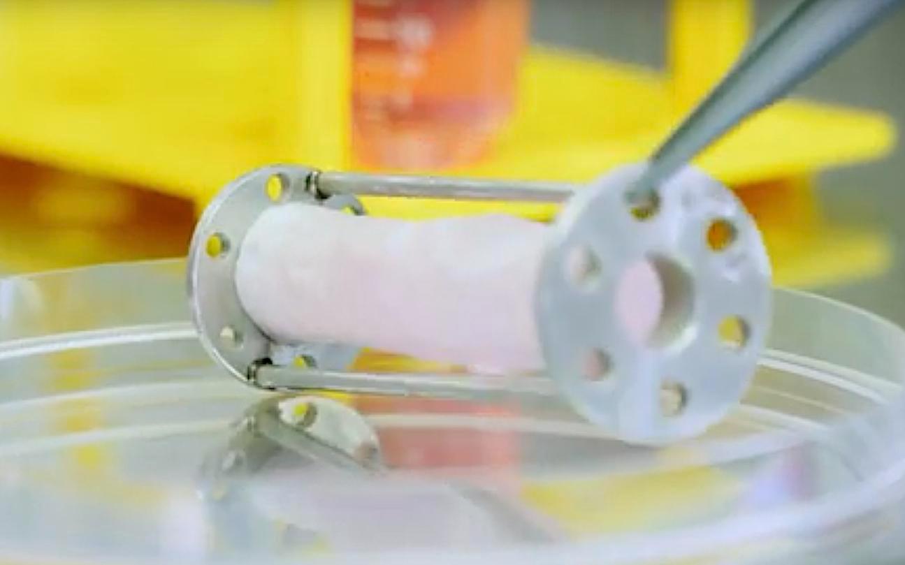 Tissue Engineering Will Disrupt Cardiovascular Implant Market Scrolller