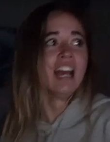 When you see his hairline | Scrolller