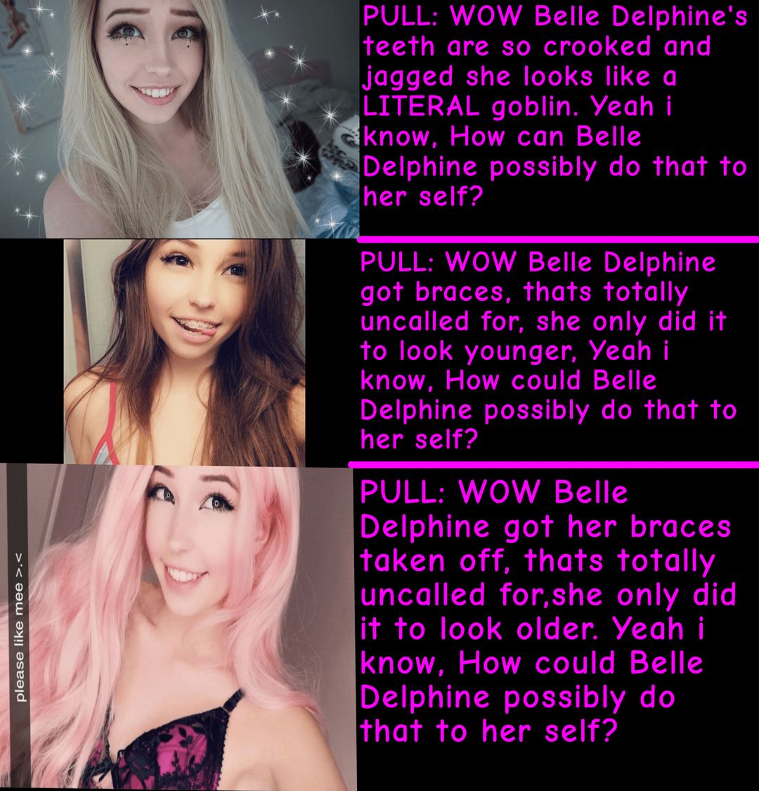 Belle Delphine Braces