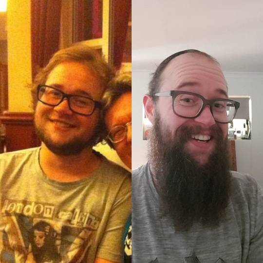 3 years post transition - 10 years post transition