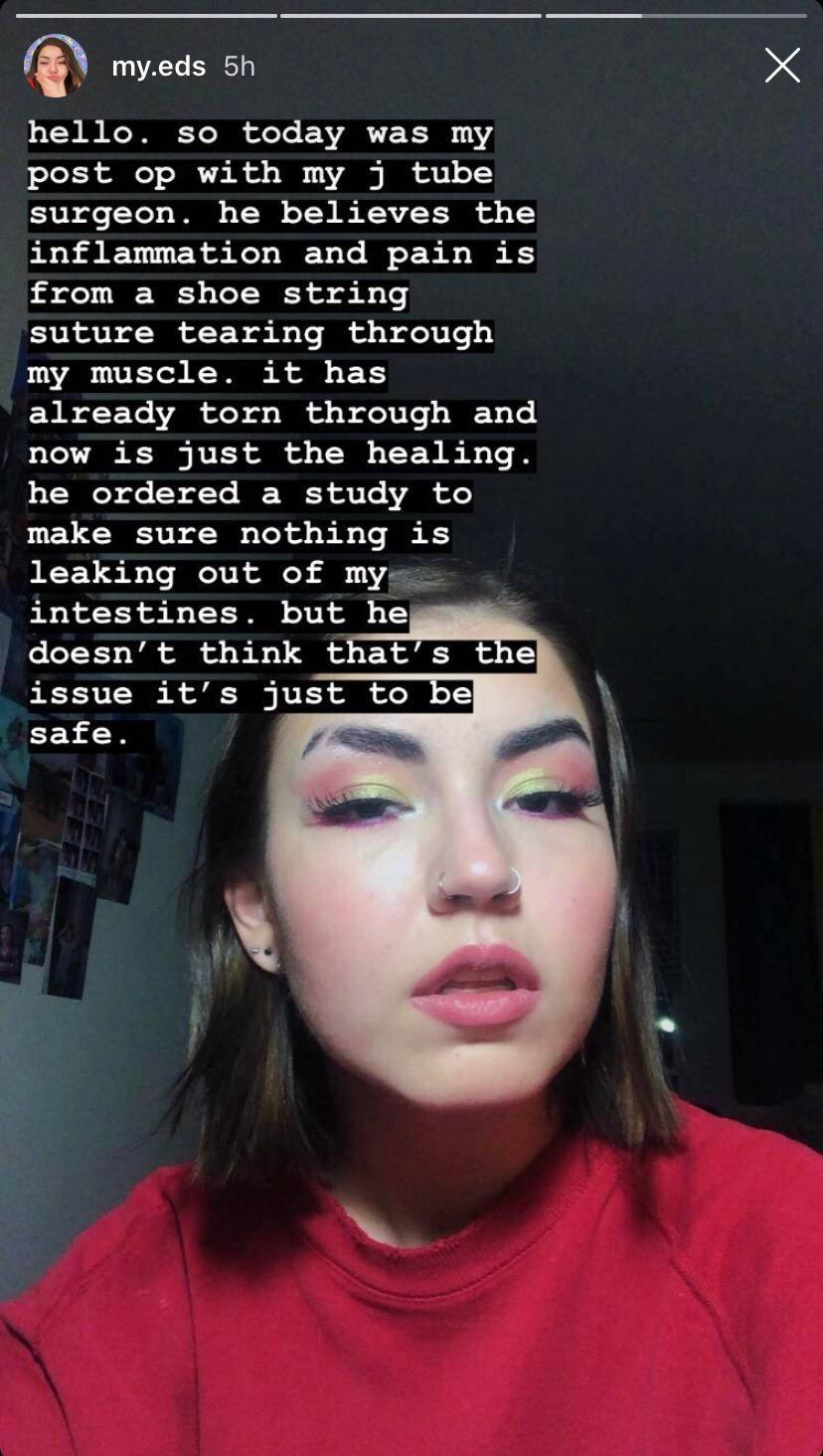 Already claiming complications from the J tube she shopped her way into