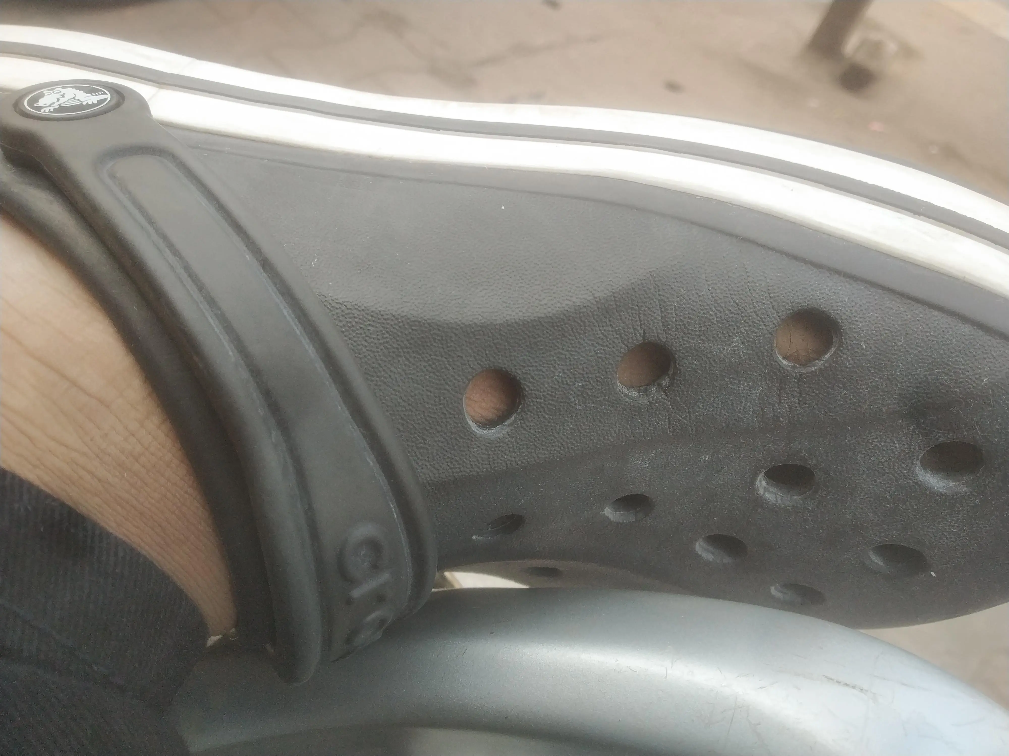 Are these cracks normal on crocs? | Scrolller