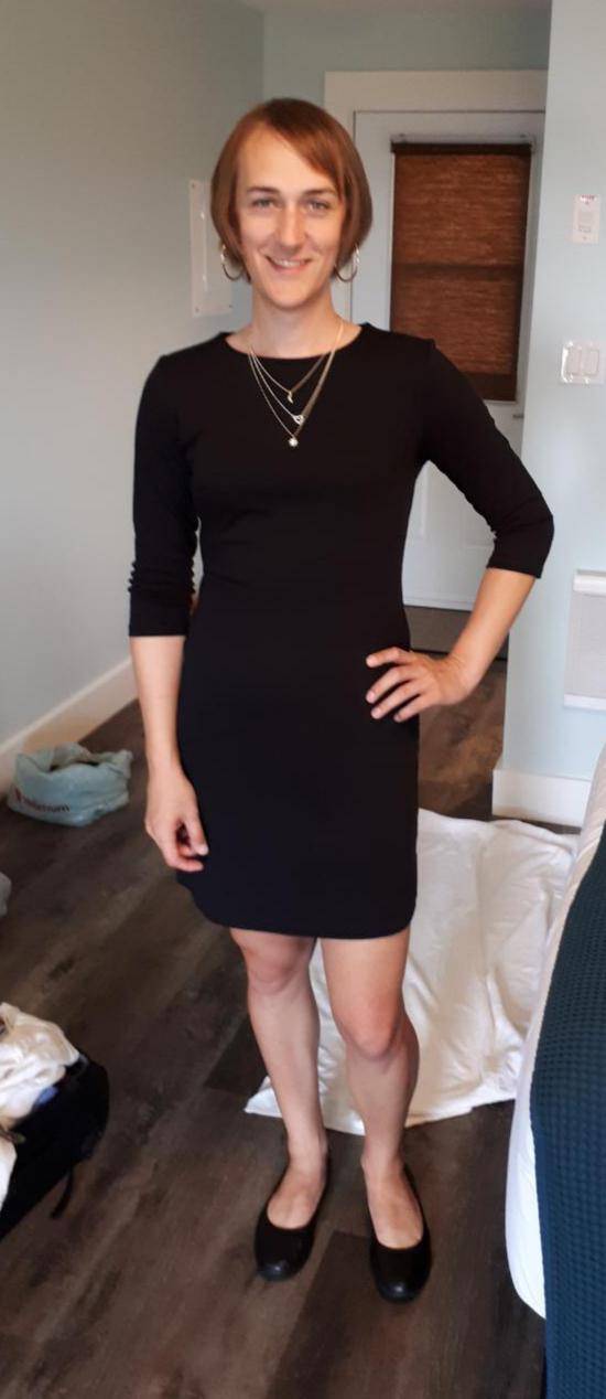 At 35, I'm trying my best to deal with my receded temples. Felt pretty good going out for dinner last weekend 😊