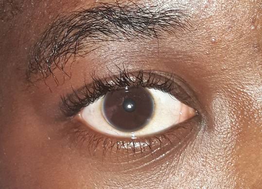 Chocolate Eye