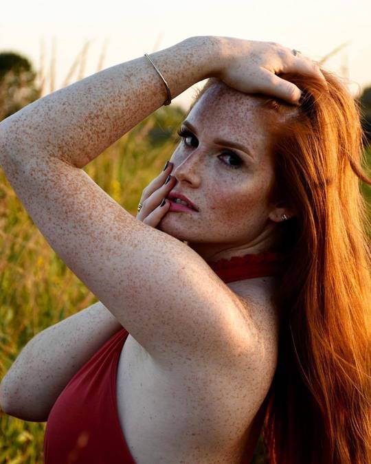 Did someone request more freckled hotties?
