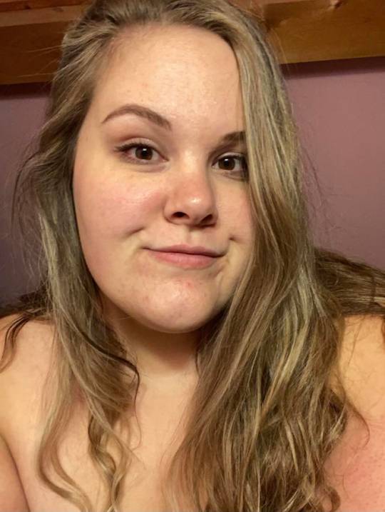 First face photo on Reddit. Eek! I've posted more elsewhere on another thread under a different user name but was too worried to show my face! Hoping it's not too bad 😇😅