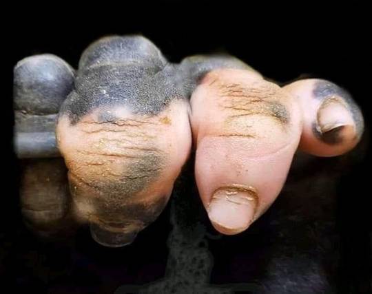 Gorilla Paw with Vitiligo