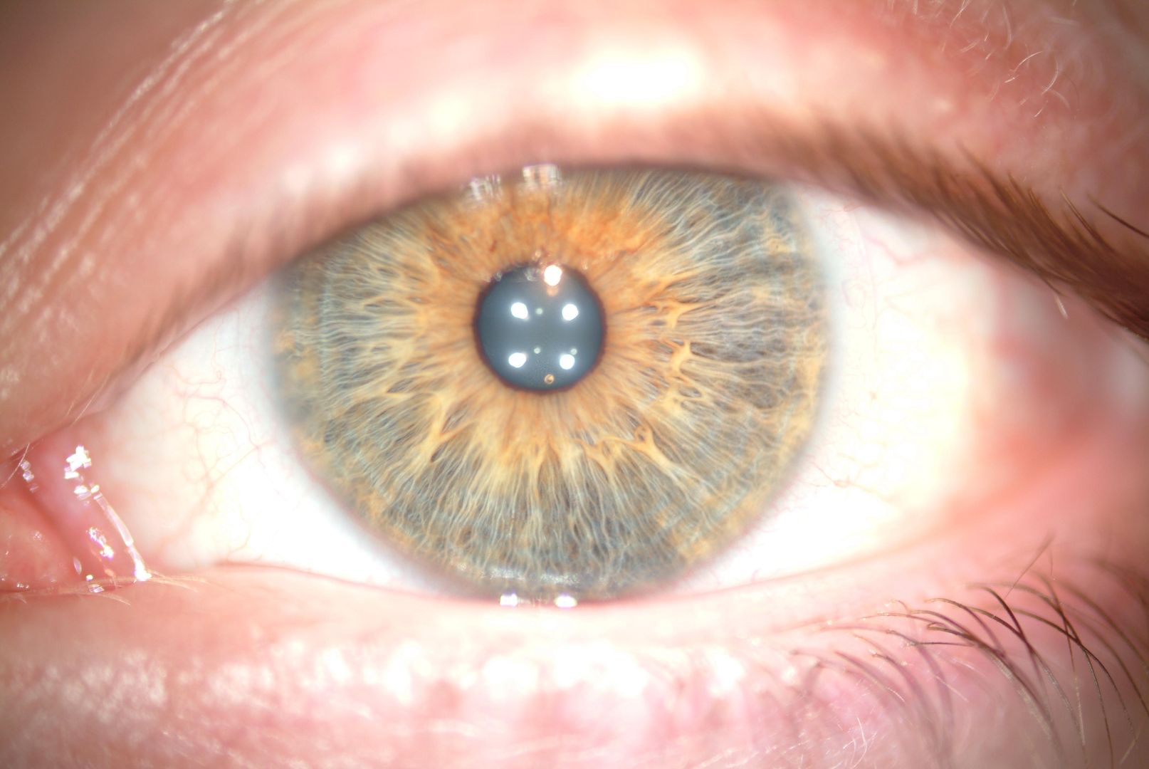 Got high-res eye images as part of an experiment 15 years ago