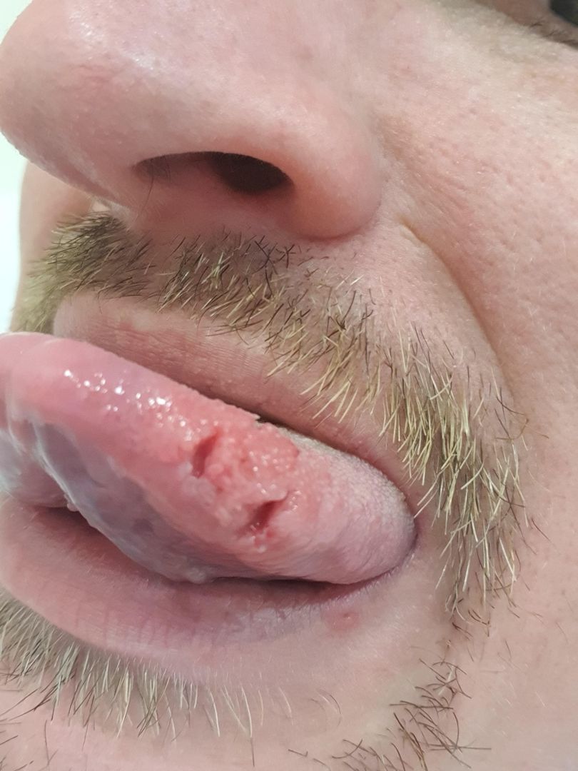 Had my worst seizure last week
