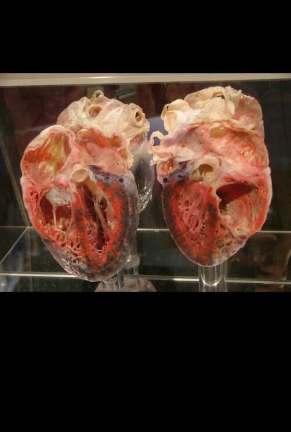 Heart cut in half