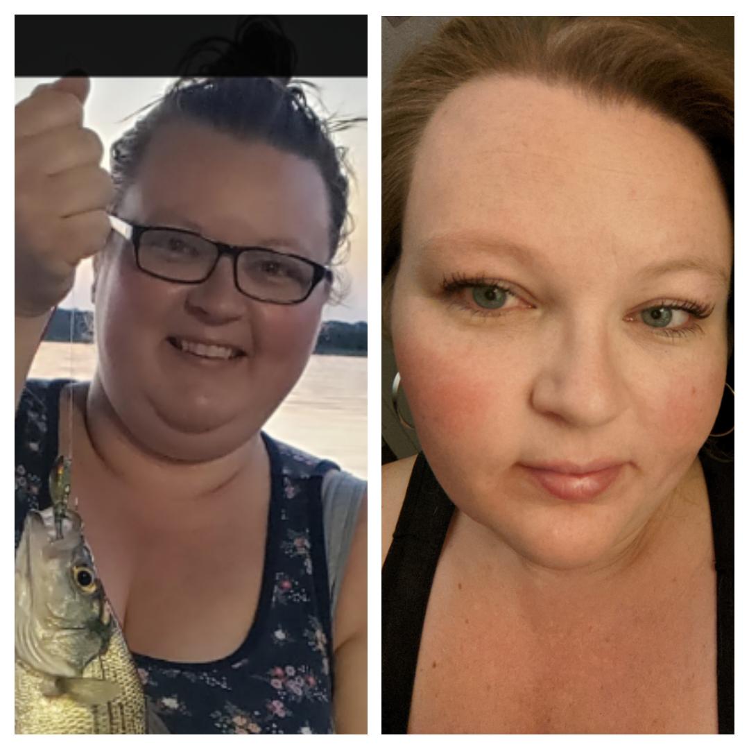 I have never done a face to face comparison because I do not take pictures of myself often. The first pic is June 2020, second pic today,December 2020. SW:256 CW: 220 GW: 180. 18:6 fasting with a mix of OMAD. Plus drs finally figured my hormone balance so I'm sure that helps too.