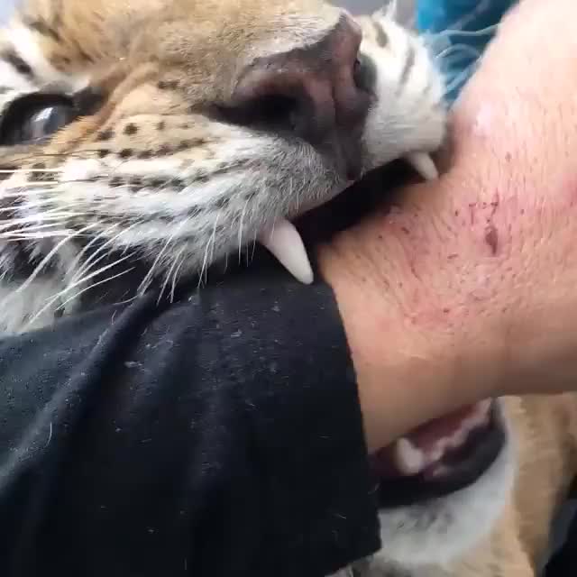 Love bites.