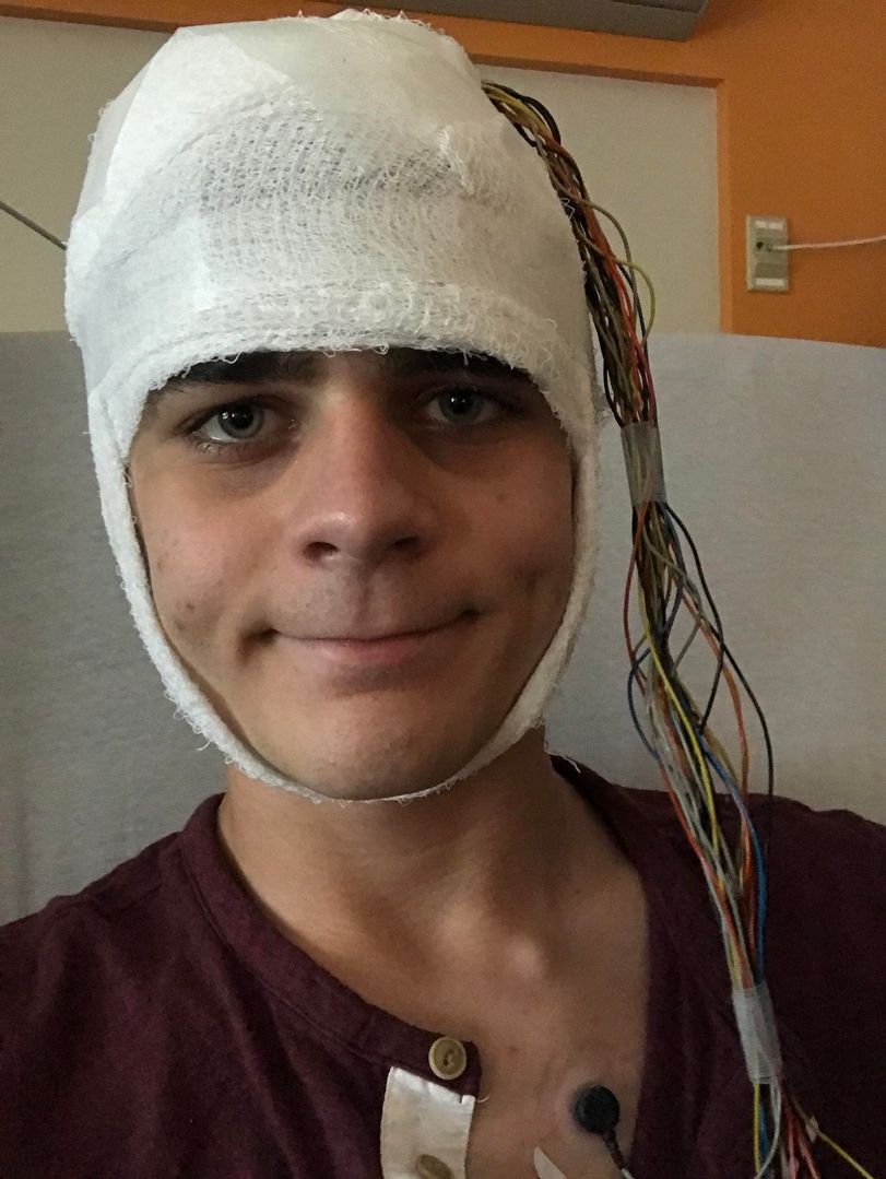 My head feels like a hard boiled egg, BUT I’m getting an EEG to make sure I’m not having seizures that we’re missing. After this if all goes well I should be able to get my driver’s license and I’m super excited! :)