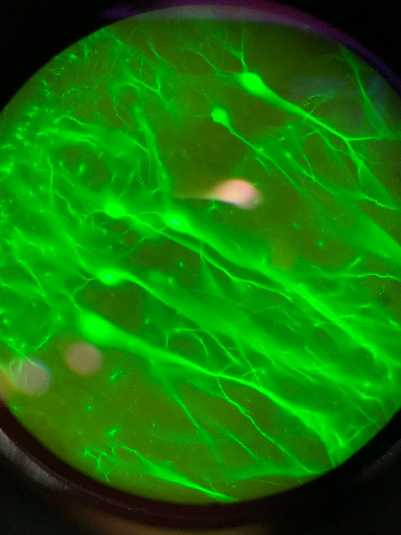 Neurons expressing GFP in brain tissue. View from the eyepiece 👁