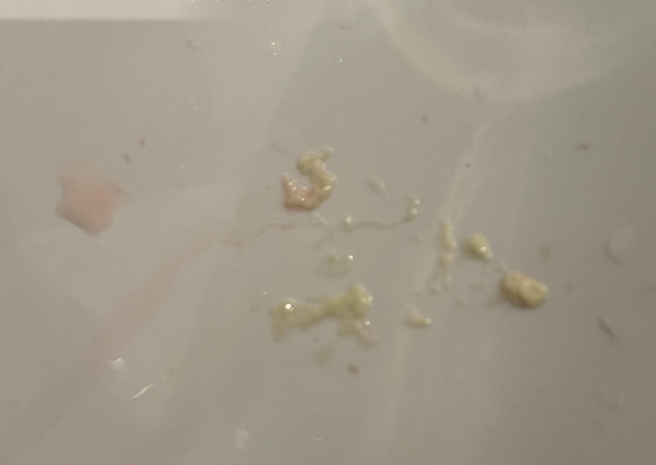 Popped a milk bleb on my nipple and unclogged a milk duct that had ...