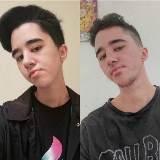 Pre-T VS 2 Years on T